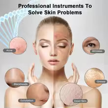 Ultrasonic Skin Scrubber Facial Cleaner Peeling Blackhead Remover